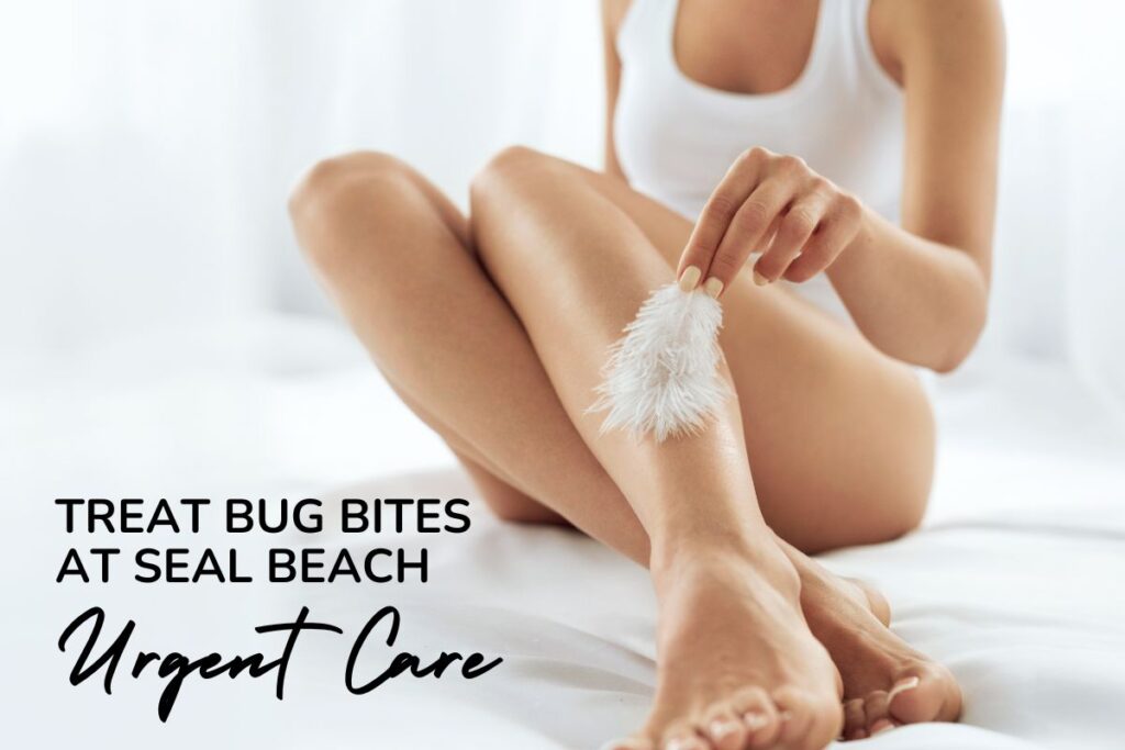 have-a-bug-bite-free-summer-with-seal-beach-urgent-care